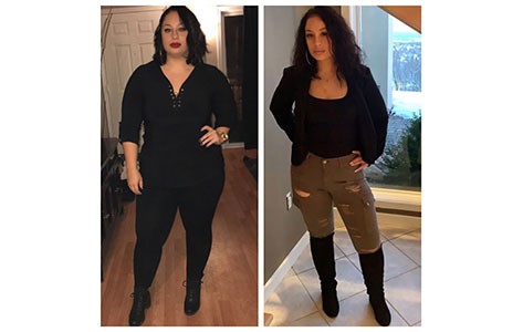 Stephanie before and after bariatric surgery at Morristown