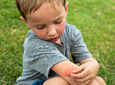 a red rash on young childs elbow