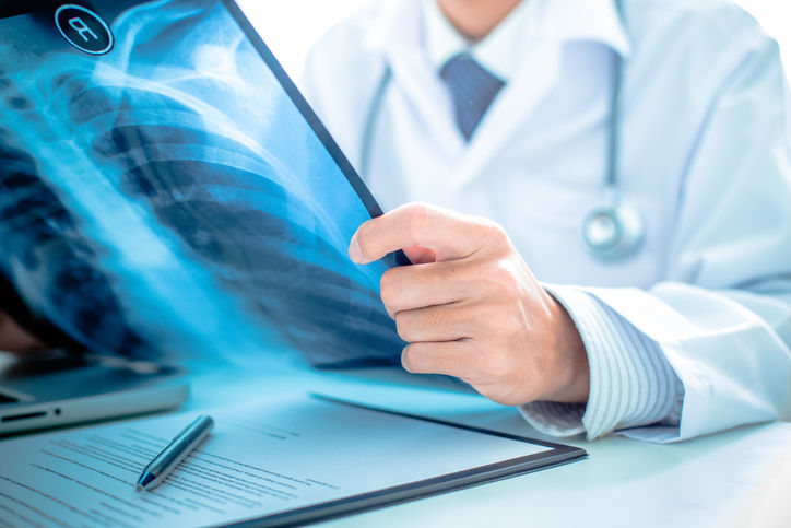 Un médico analiza una radiografía de tórax mientras está sentado en su escritorio.