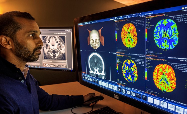 neurorradiólogo leyendo los resultados de las pruebas de imágenes cerebrales
