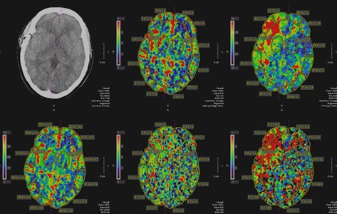 neuro scans
