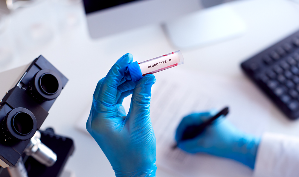 Blood tests