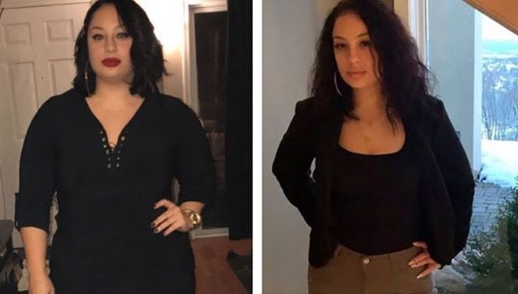 Stephanie before and after bariatric surgery.
