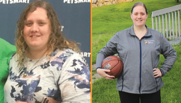 Mary before and after bariatric surgery.