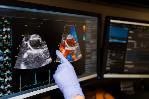 Specialist looking at cardio screen