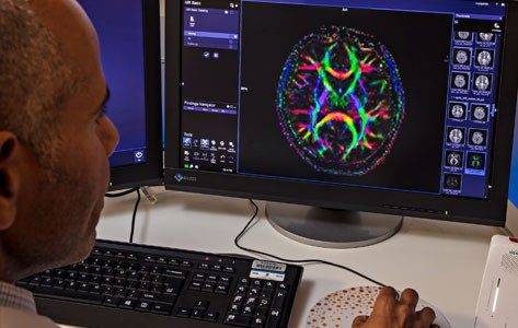 Diagnostic radiologist looks over a 3T magentom image